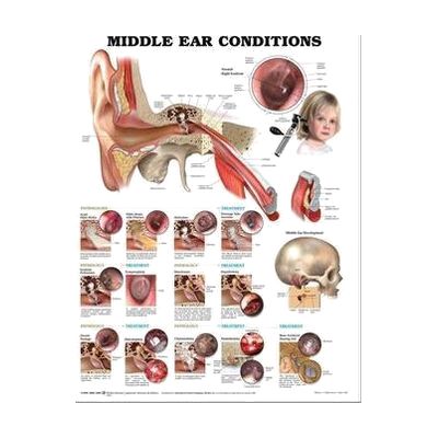 A laminated wall chart with a large ear cross-section diagram and rows of small ear condition photos.